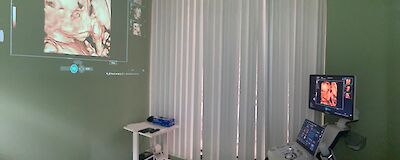 Ultrasonido Obstétrico 